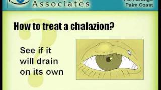 chalazion mpeg1at800600at7k [upl. by Nyliuqcaj]