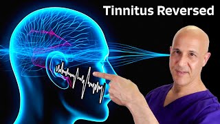 Tinnitus Reversed The Miracle of 1 Nutrient Dr Mandell [upl. by Nagap457]