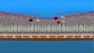 Edema Macular y Isquemia Macular [upl. by Hibben316]