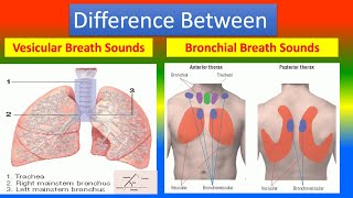 Difference Between Vesicular Breath Sounds and Bronchial Breath Sounds [upl. by Nraa]