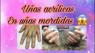 Uñas acrílicas en uñas mordidas  TRANSFORMACIÓN DE UÑAS mordidas [upl. by Maighdlin]