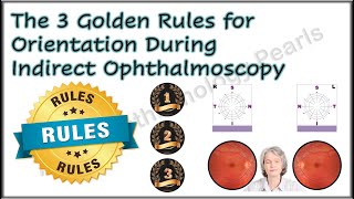 The 3 Golden Rules for Orientation During Indirect Ophthalmoscopy [upl. by Maram70]