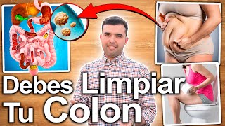 ESTO INDICA COLON SUCIO  Sintomas De Que Necesitas Una Limpieza De Colon [upl. by Ecnadnac534]