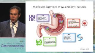 Keynote Lecture 1 Unraveling the taxonomy in gastric cancer [upl. by Enneirb]