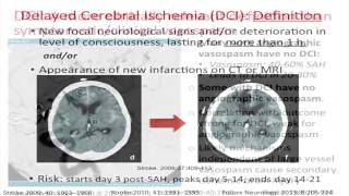 ICU Management of Subarachnoid Hemorrhage by Amedeo Merenda MD [upl. by Rehpotsihrc]