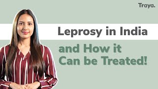 Leprosy in India and how it can be treated  World Leprosy Day [upl. by Boudreaux555]