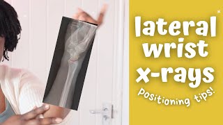 My perfect lateral wrist xray technique  Ask The Rad Tech [upl. by Hurlbut]