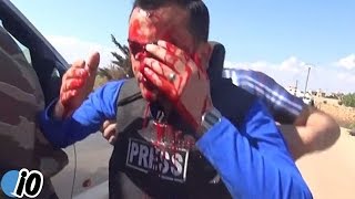 Reporter Hit By Shrapnel Live On Camera [upl. by Ahtrim577]