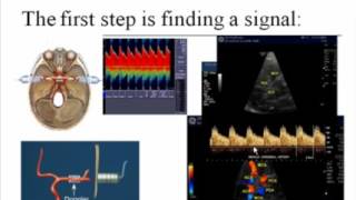 An Introduction to Transcranial Doppler [upl. by Eltsyrk]