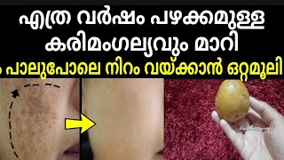 കരിമംഗല്യം മാറാൻ ഇതിനേക്കാൾ നല്ല വഴി ഇനി സ്വപ്നങ്ങളിൽ മാത്രംbest treatment for pigmentation on face [upl. by Amirak]