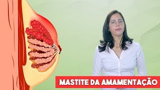 Mastite durante a amamentação mastite lactacional [upl. by Nofets]