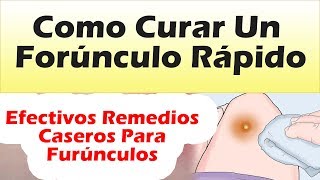 Como Curar Un Forunculo Rapido Con Efectivos Remedios Caseros COMO MADURAR UN FORUNCULO [upl. by Paulsen]