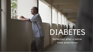 Diabetes Reflection after a below knee amputation [upl. by Carmine]