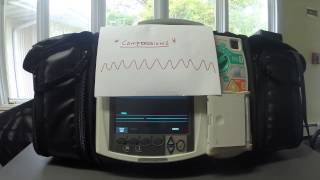 Manual Defibrillation [upl. by Nabe]