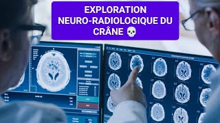 RADIOLOGIE☢️ INITIATION DE LEXPLORATION NEURORADIOLOGIQUE DU CRÂNE 3ÈME MÉDECINE✅✅Unité2🧠🦴🩺 [upl. by Leahcimaj]