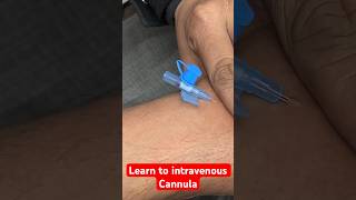 Learn to intravenous cannula  कैनुला लगाना सीखे सीखे shorts new trending SMpharmacy [upl. by Gnahk705]