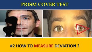 PRISM COVER TEST  everything you need to know [upl. by Gamber]