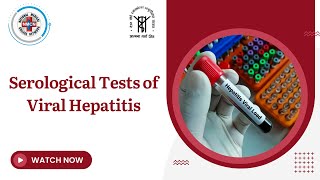 Serological Tests of Viral Hepatitis [upl. by Latona288]