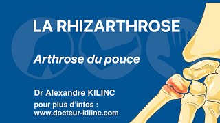 Rhizarthrose ou Arthrose du pouce explications du Dr Kilinc [upl. by Jar864]