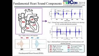 A Novel Algorithm Based on Stockwell Transform for Boundary Detection and Segmentation of Heart PCG [upl. by Amabil190]