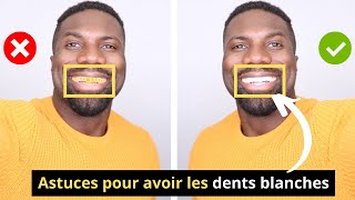 Comment Avoir Les DENTS BLANCHES  BLANCHIR SES DENTS [upl. by Electra]