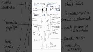 Klinefelter syndrome  Genetic disorder medical neetpg education genetics mbbs revision [upl. by Aronle]