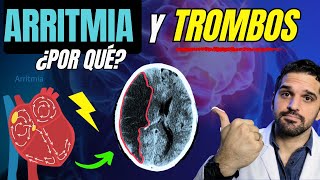 Lo que NO SABÍAS de esta ARRITMIA Fibrilacion Auricular ⚠️ [upl. by Ruford]