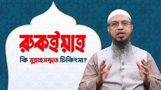 রুকইয়া কি সুন্নাহসম্মত চিকিৎসা ইসলামী প্রশ্নোত্তর II Sheikh ahmadullah live [upl. by Moorefield]