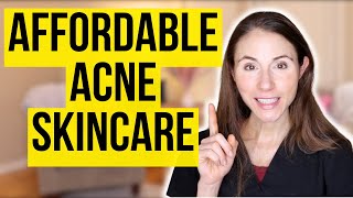 Affordable Skincare For Acne Prone Skin [upl. by Ginsburg]