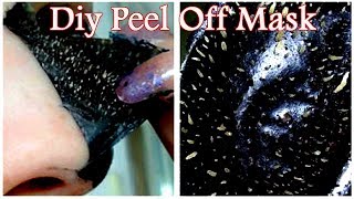 Remove Blackheads amp Whiteheads Easily At Home With DIY Peel Off Mask [upl. by Reube435]