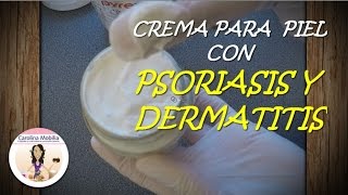 Crema para la Psoriasis y Dermatitis [upl. by Gibson]