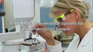 Toenail Fungus Treatment Video [upl. by Koo]