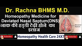 Homeopathy medicine for deviated nasal septum [upl. by Samul]