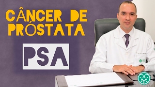 Exames fundamentais para detectar o câncer de próstata  Messina Clinic [upl. by Geesey25]