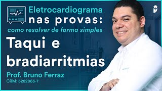 Taqui e bradiarritmias  Eletrocardiograma [upl. by Naletak]