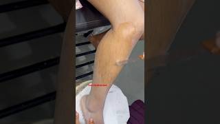 What is Liposoluble gel wax liposolublewax shorts [upl. by Kumar95]