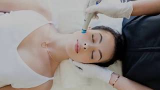 HydraFacial Procedūra Kaune  wwwamberestheticlt [upl. by Shirl]