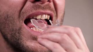 How to mold teeth whitening trays at home [upl. by Kenwee]