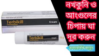 Terbikill cream  টারবিকিল ক্রিম  নখকুনি দূর করার উপায় [upl. by Vernen]