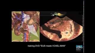 Longitudinal EUS  Anatomical Guiding Structures in the Upper Abdomen Cranial  Left [upl. by Haisa]