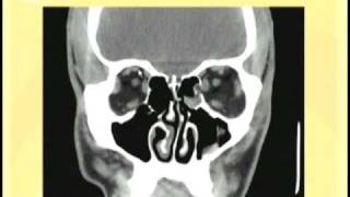 Ophthalmology Lecture  Eye Anatomy Part 3 [upl. by Naret919]