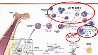 Aplastic Anemia Approach on Diagnosis and Treatment Options 2018 [upl. by Snowman850]