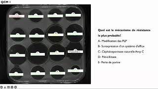 Lecture interprétative de l’antibiogramme de Pseudomonas aeruginosa [upl. by Otha674]