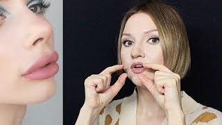 Would LIP FILLERS suit YOUR face [upl. by Ynobe]