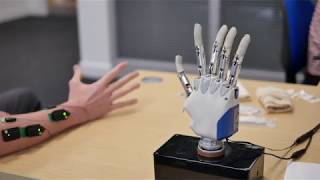 Improving the control of prosthetic hands [upl. by Gneh]