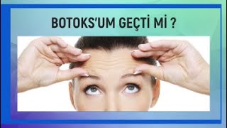 BOTOKSUM GEÇTİ Mİ [upl. by Esmond]