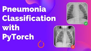 Detecting Pneumonia from Chest XRay images with PyTorch [upl. by Easter297]