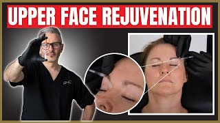 Upper Face Injection techniques  Botox amp Filler Periorbital Rejuvenation Tutorial [upl. by Gnuhp]