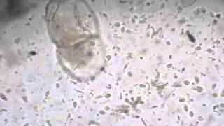 giardia Lambilia cysts amptrophozoites [upl. by Anaili]