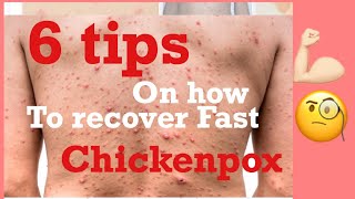 6 Tips On How To Recover Fast In Chickenpox Bulutong Tubig [upl. by Anires]